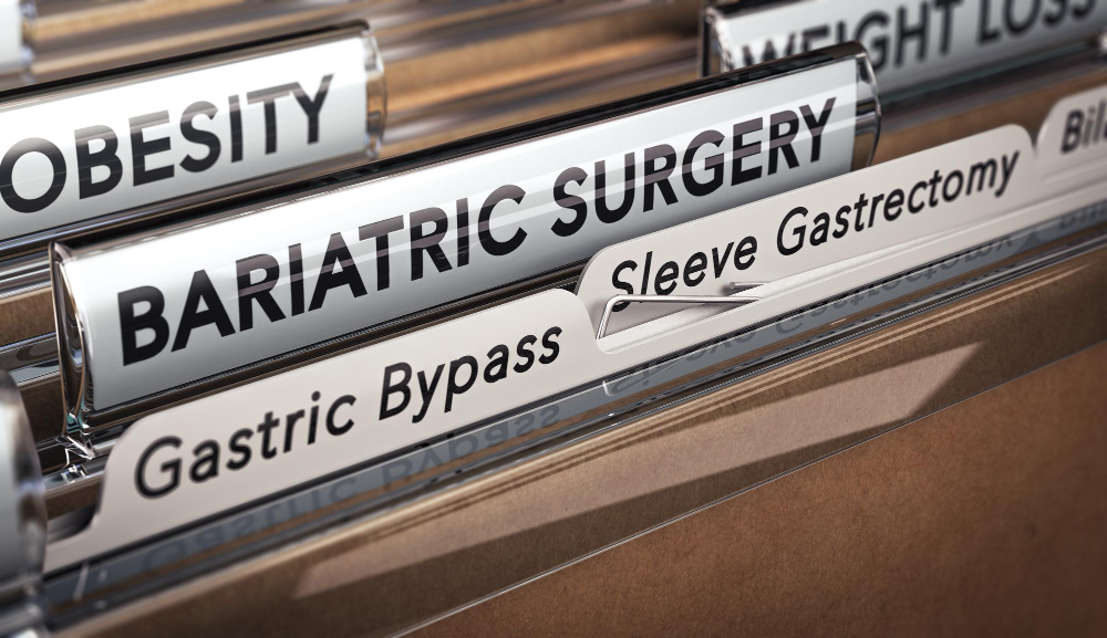 Sleeve Gastrectomy Surgery - A Solution for Morbid Obesity?