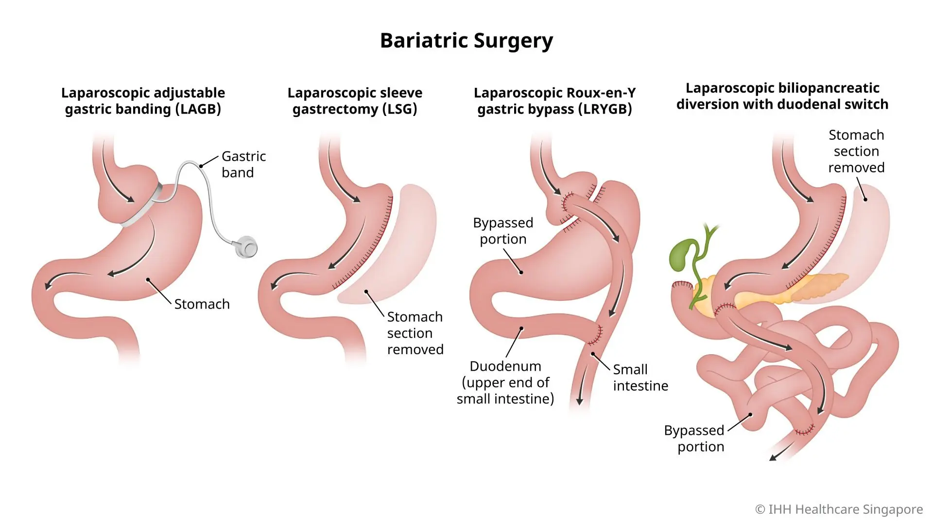 Pre- and Post-Op Care: Changing Your Lifestyle