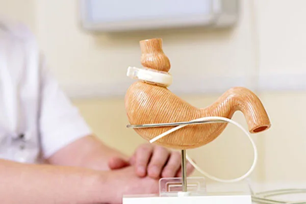 Gastric Band Turkey Antalya