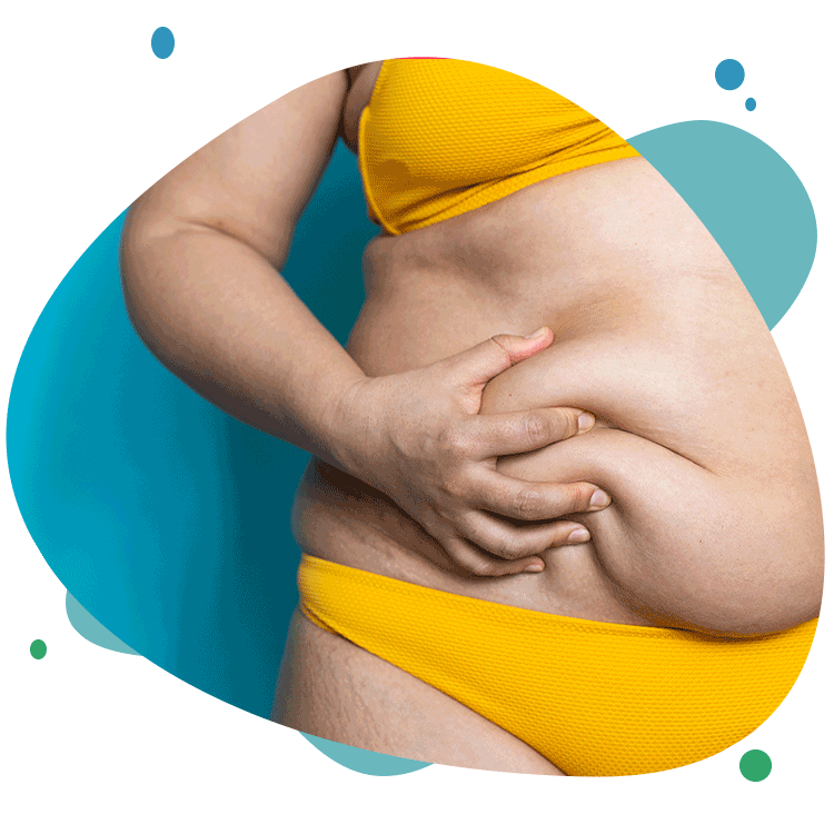 What is gastric bypass?
